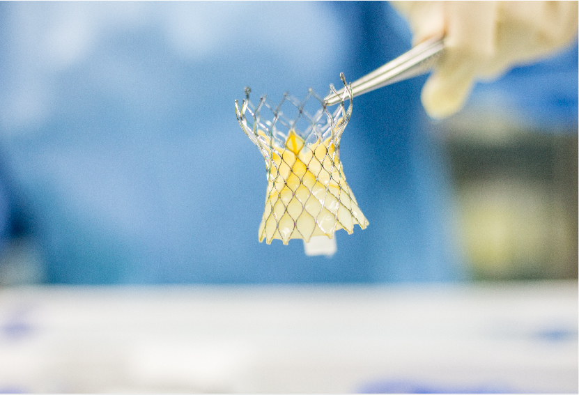 What is the Heart Valve Replacement Cost in India?