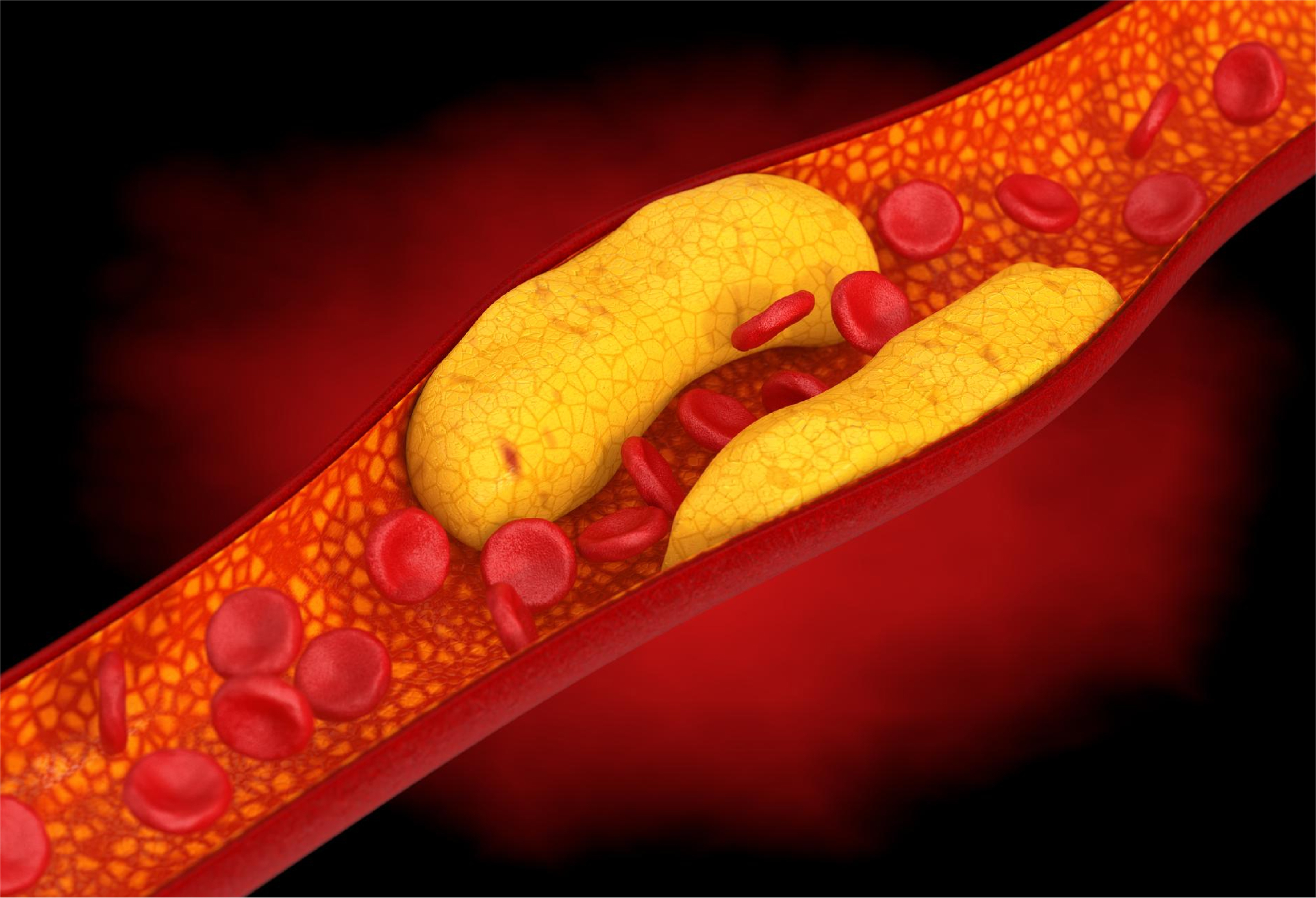 Difference Between Good Cholesterol and Bad Cholesterol