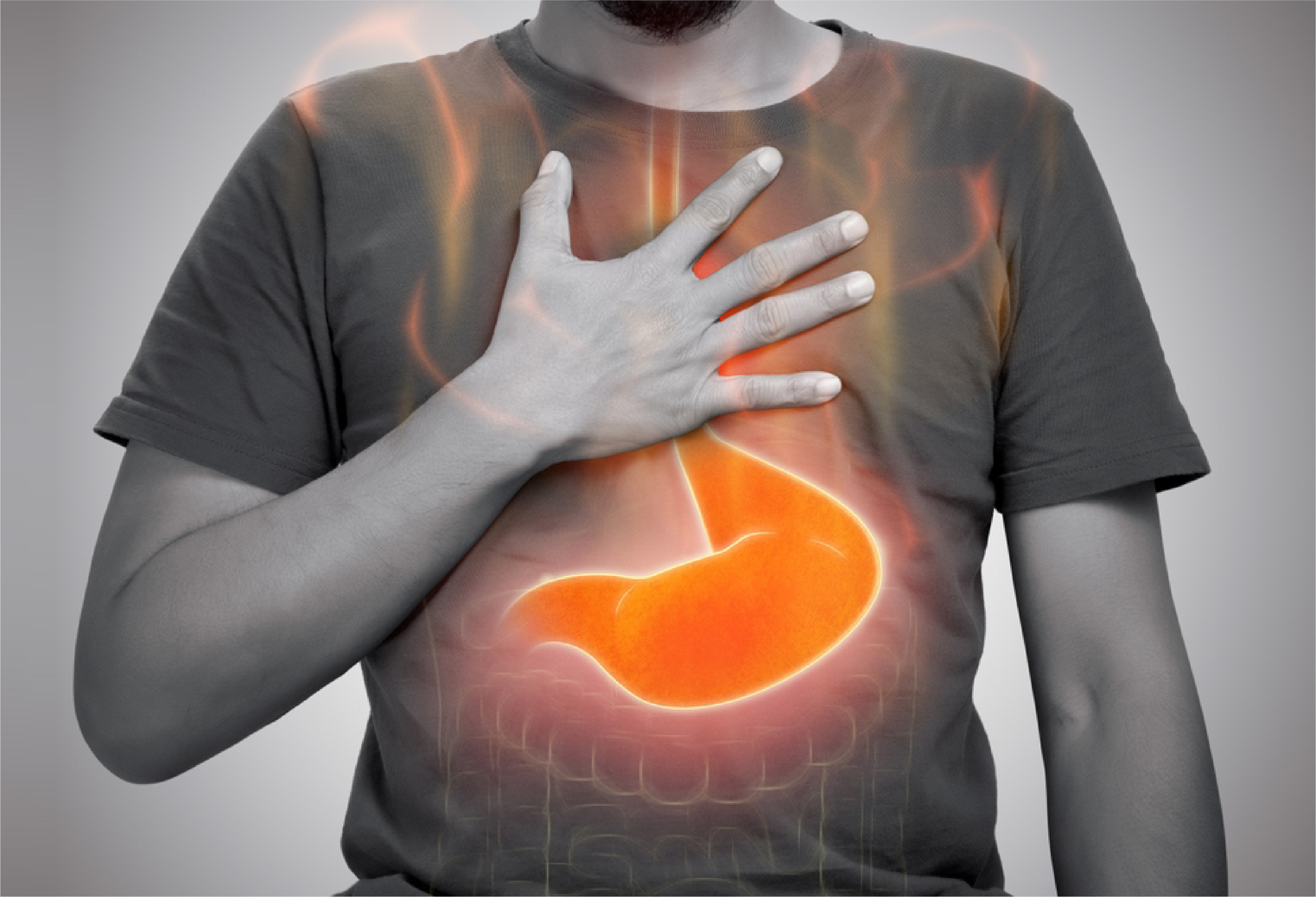 What Is Heartburn? Symptoms, Causes, And Effective Home Remedies