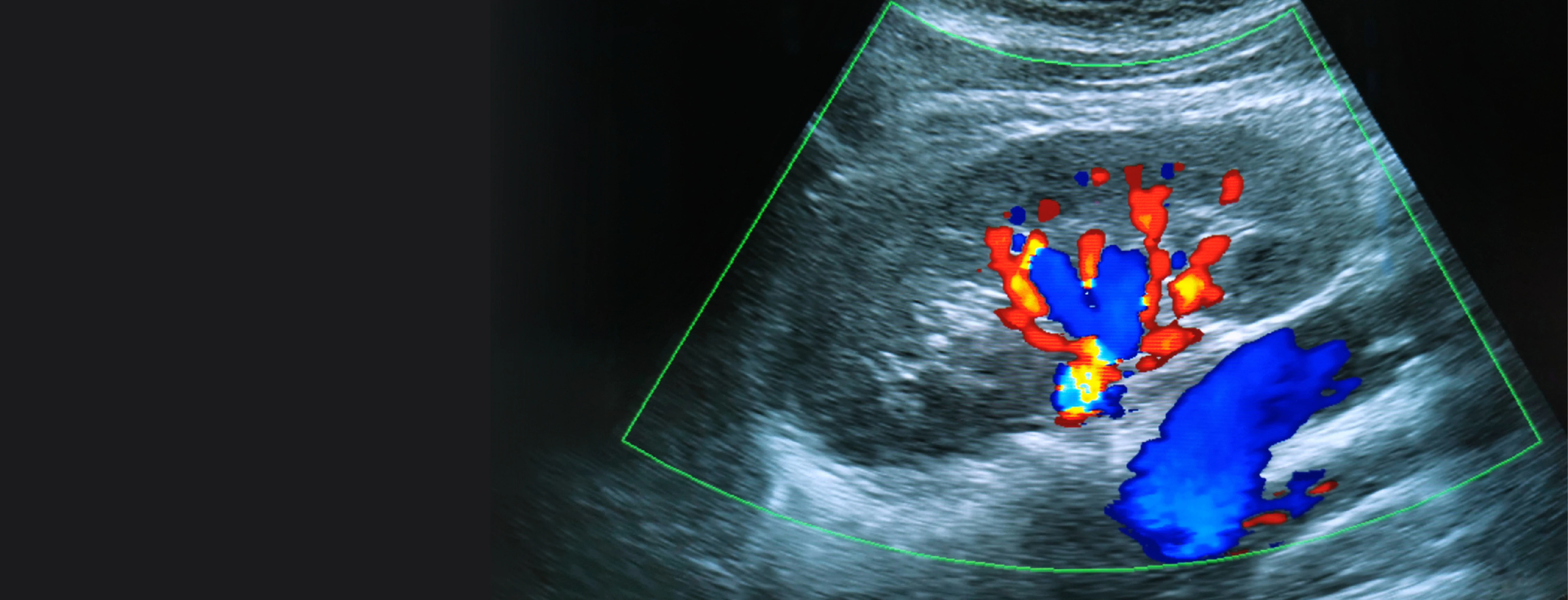 Color Doppler Test Price in Chennai, India