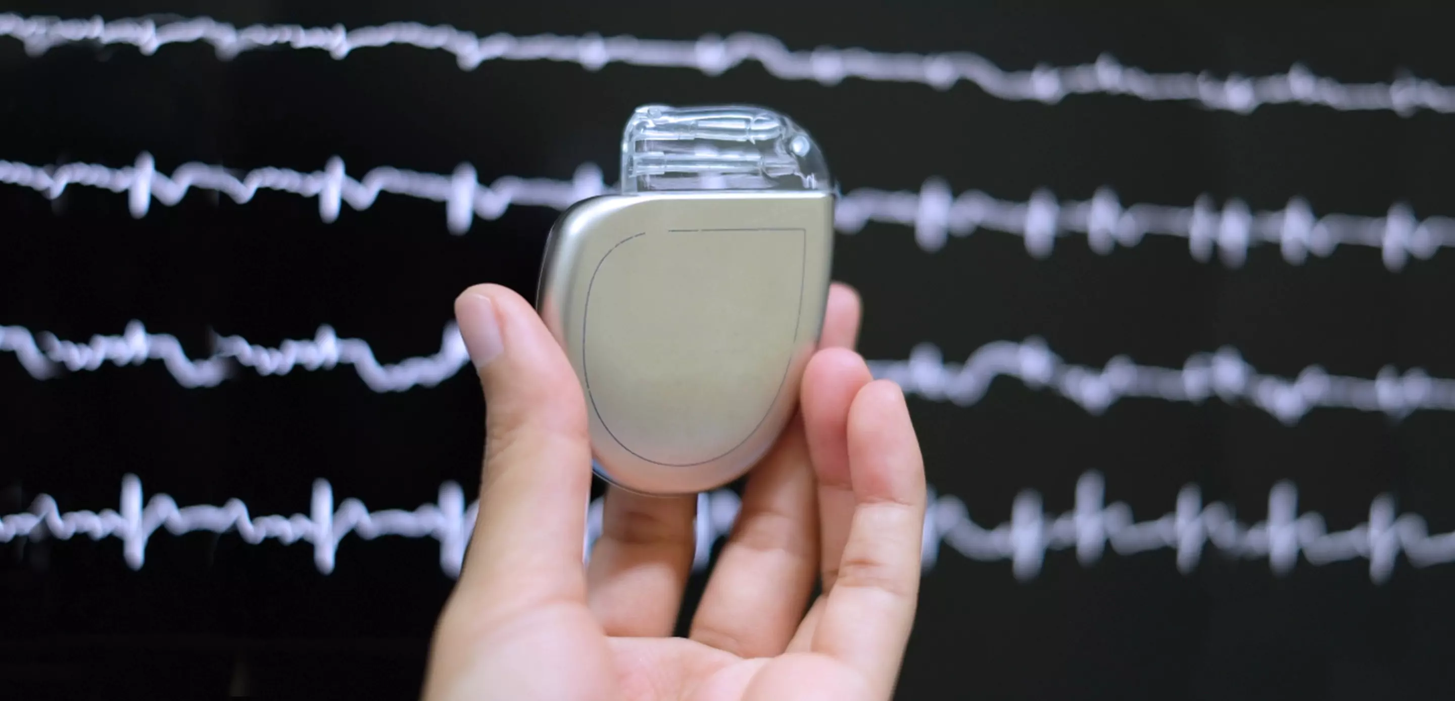 Electrophysiology