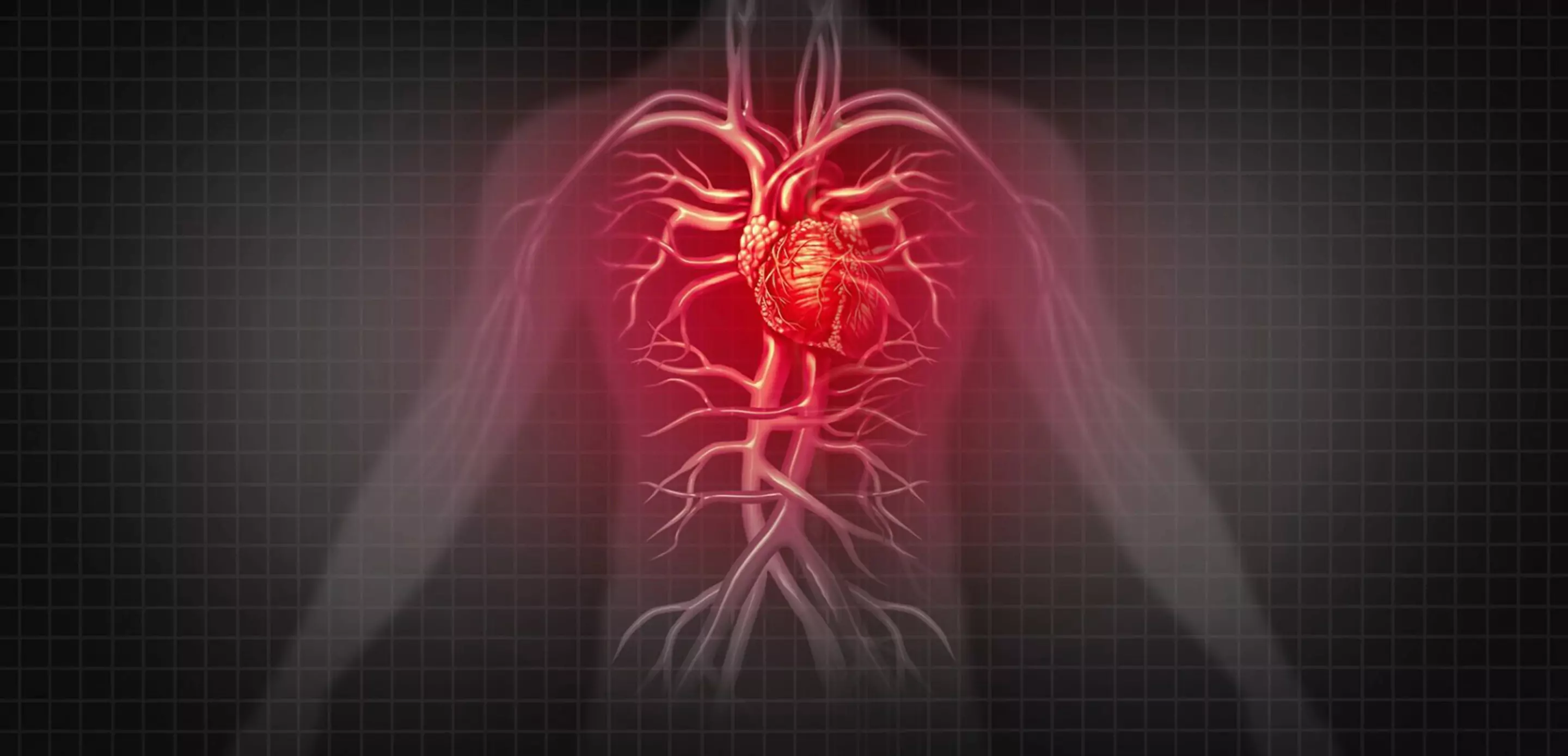 Percutaneous Valvular Interventions