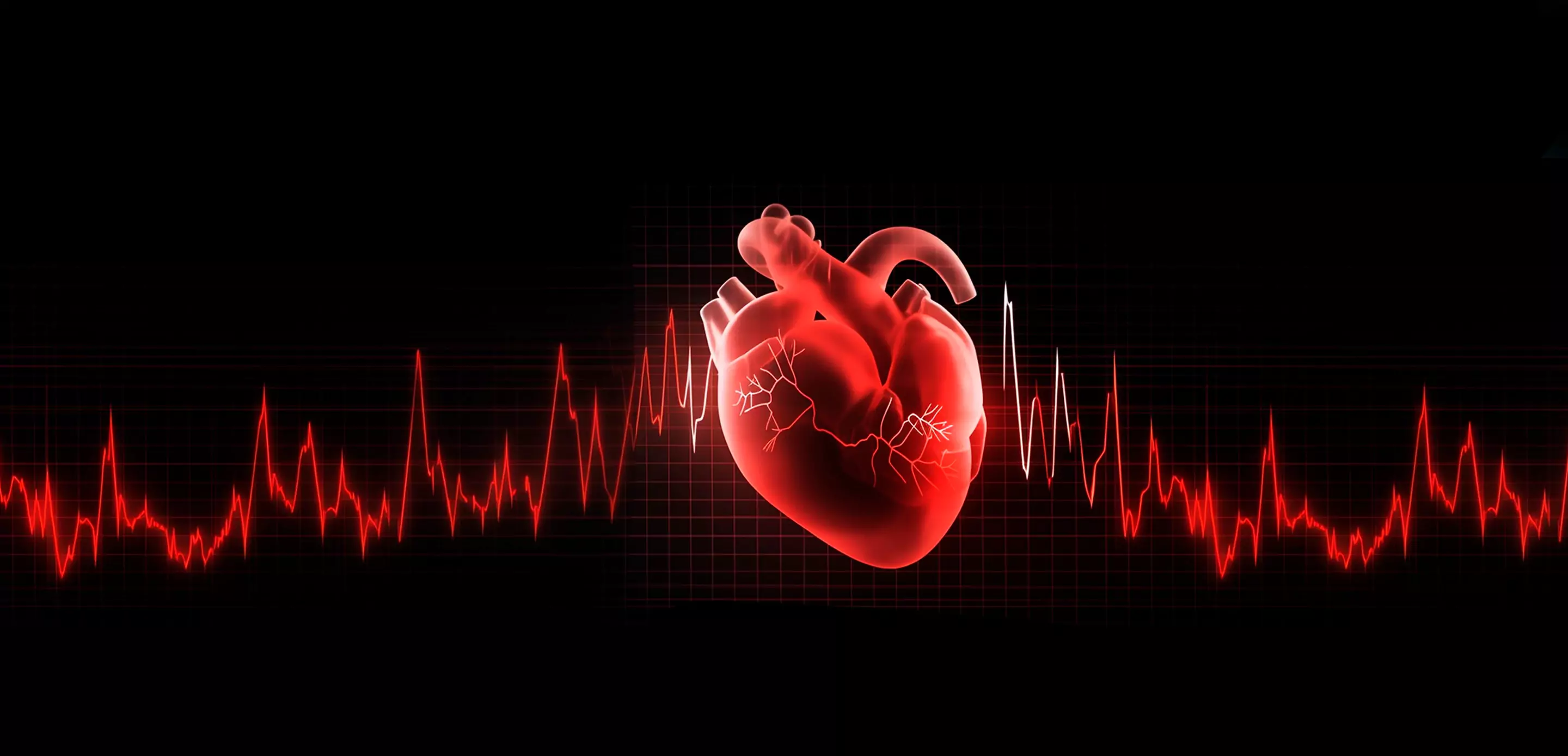 Percutaneous Valvular Interventions