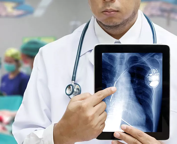 68d642a28c34eepacemaker_implantation.webp